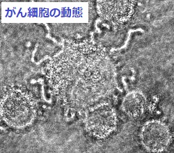 レーザ位相差顕微鏡へのリンク